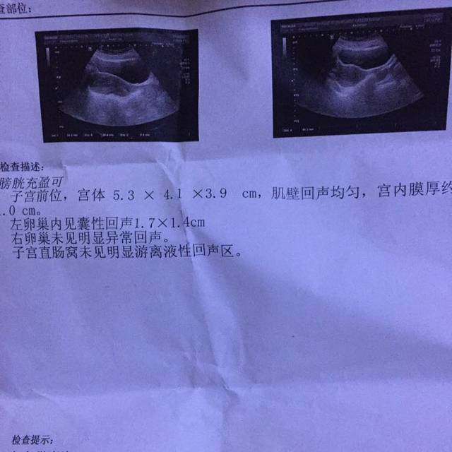备孕期间,上月检查有卵巢囊肿!B超单请大伙帮