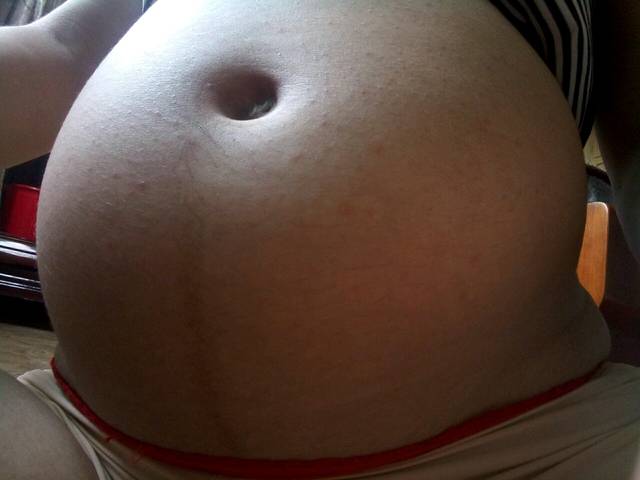小红点的原因_怀孕7个月了,突然发现肚皮上长
