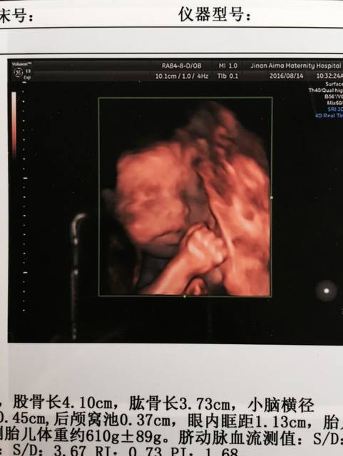 四维彩超好希望不要翻盘啊!_四维彩超归来,宝