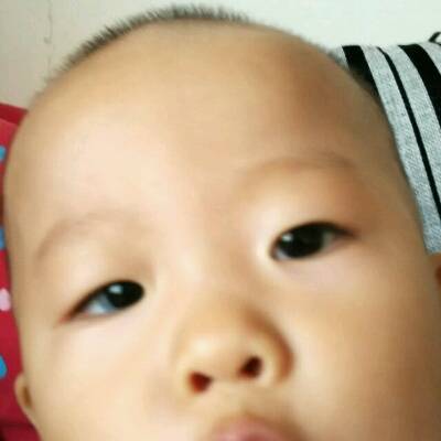 宝贝右眼白眼球和黑眼珠附近有一片蓝色。看东