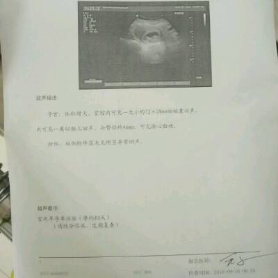 今天做彩超的那个女医生说我的宝宝比预期的长