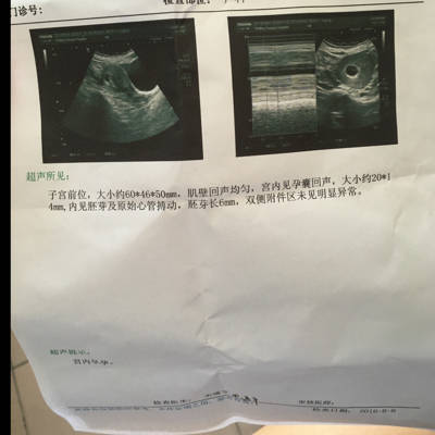 我现在怀孕刚好2个月 孕酮开始是19.72 隔5天