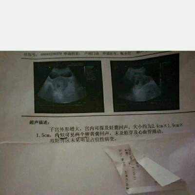 一个孕囊,疑似两个卵黄囊,不见胎芽和心率脉搏