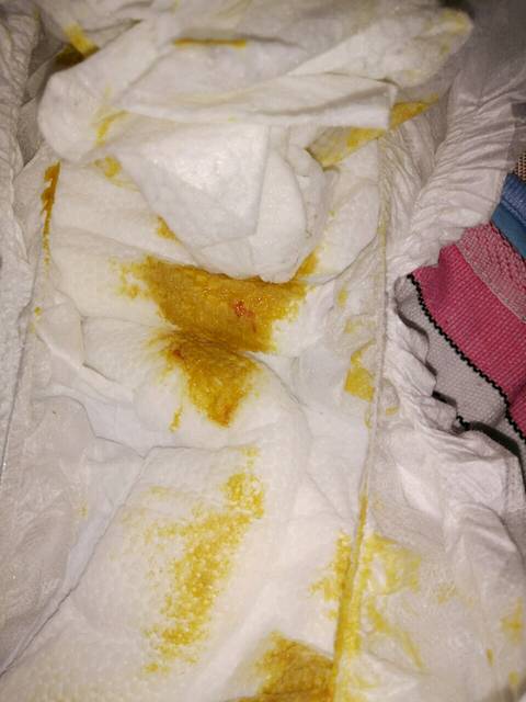 宝宝便便红色物质,星星点点的像血丝,跪求有经