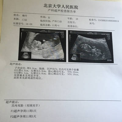 专家老师好,我是双卵双胎,NT医生说一个清楚一个不清楚。让我17-18周再去照一次。我很担心照的不清楚的孩子有什么问题,请专家帮我看下B超单谢谢!_育儿问答_宝宝树