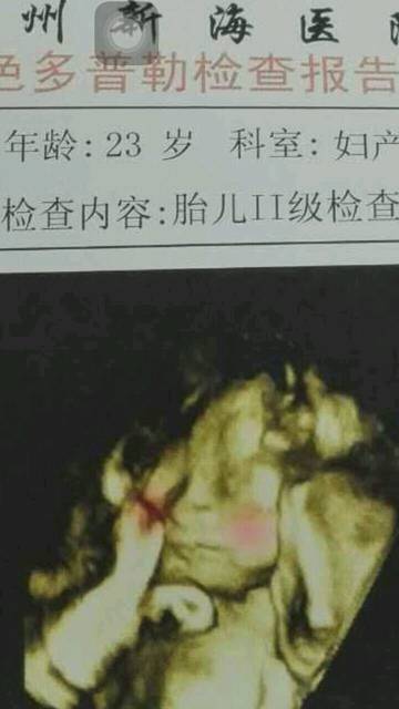 怀孕6个月,求推荐钙片和DHA_之前买了一瓶惠