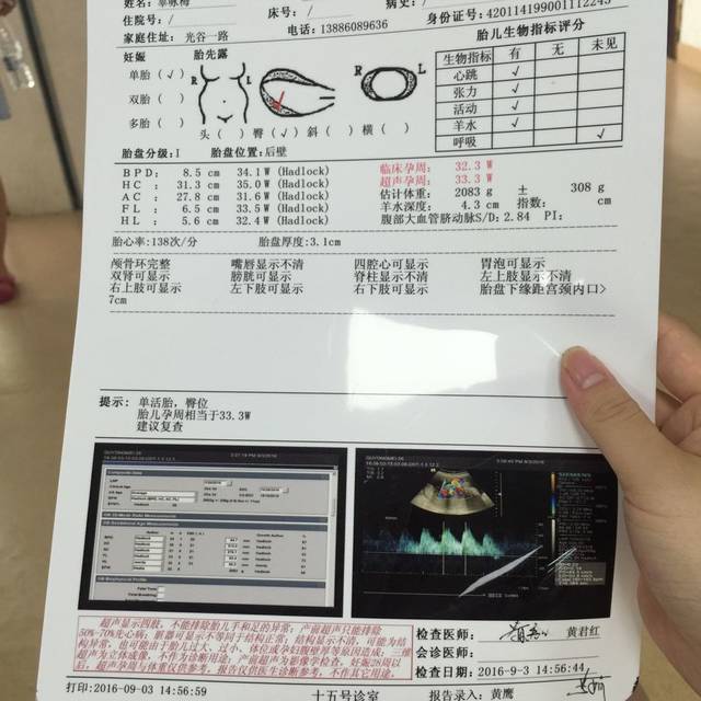 还愿了,感谢菩萨保佑,32周检查宝宝一切正常_