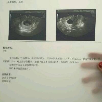 宫腔积液有没有事?还有我这个算是圆的还是长的?_育儿问答_宝宝树