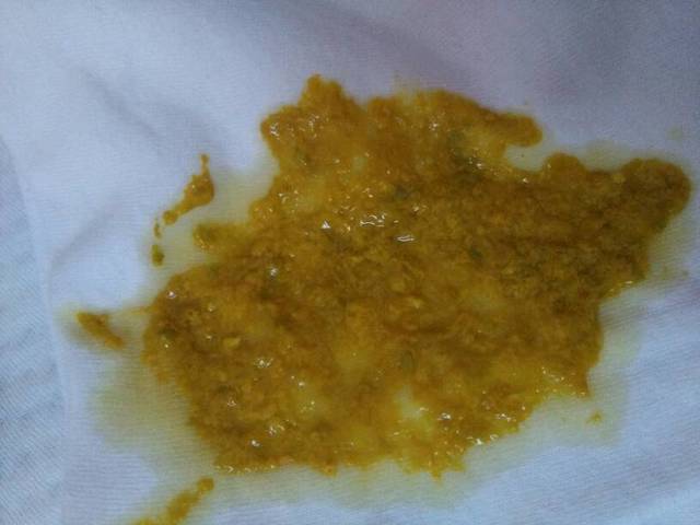 宝宝大便次数多还稀_十来天的宝宝,一天拉八九