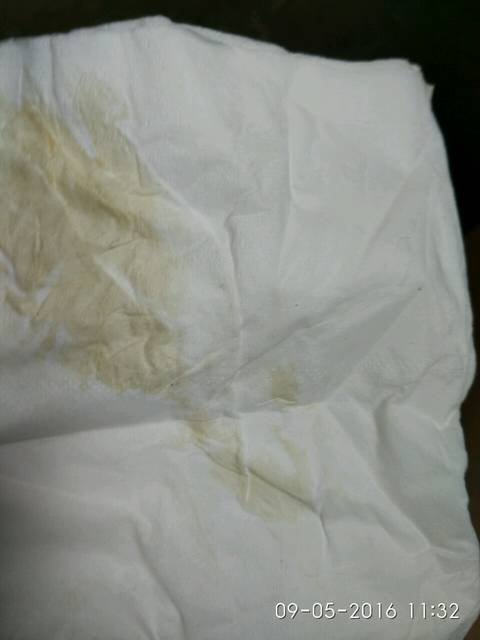 怀孕两个月不知道是流血还是褐色分泌物,都几天了一直