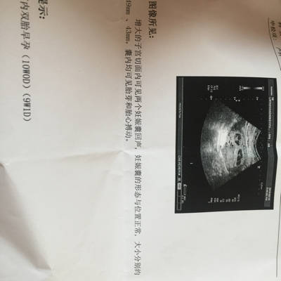 育儿问答 怀孕期 我60天的时候做彩超医生告诉我是双胎有两个孕囊有