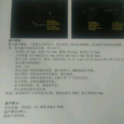 孕38周啦,但还是好奇宝宝到底是男是女好取名