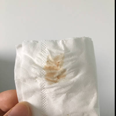 孕43天有胎芽胎心,孕酮26 hcg大于50000,每天都会小腹刺痛和腰酸,40天流淡褐色,吃了保胎药一天后,现在褐色多了,体温也下降到36.7,现在怎么办?_育儿问答_宝宝树