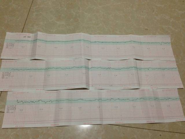 有医生吗,帮我看看胎监图,谢谢了!_做了三次,都