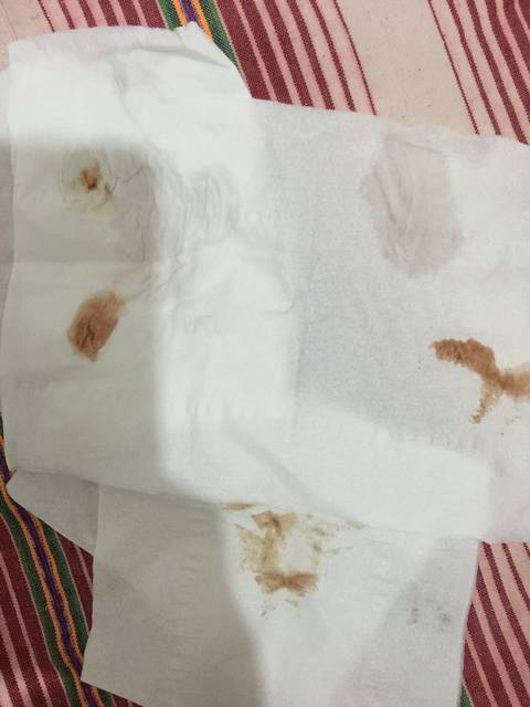 流褐色分泌物怎么办_最近一直感冒,也不敢吃药