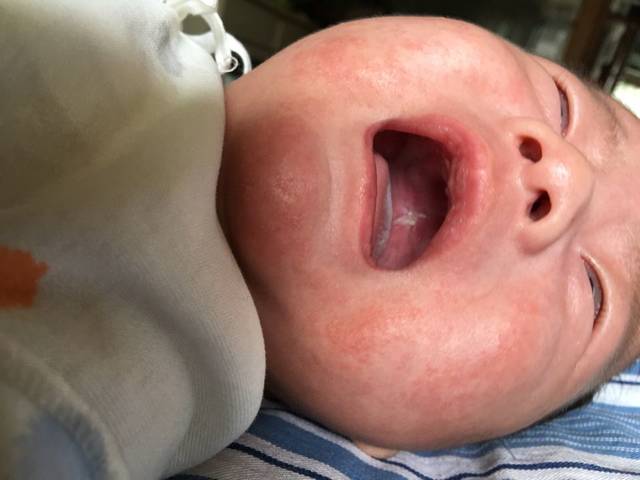 宝宝上颚白色坑是怎么回事_宝宝一个多月了,上