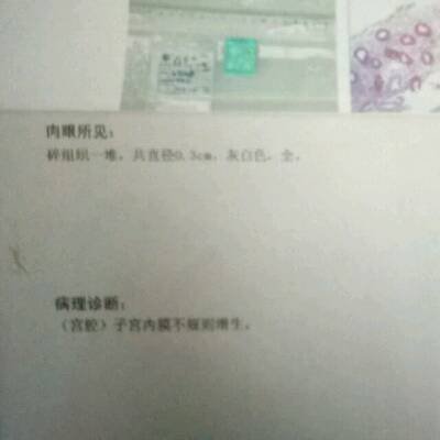 请问子宫内膜不规则增生是什麼意思啊,做宫腔镜检查后化验出来的