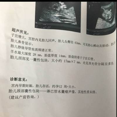 怀孕12周发现胎儿有颈部囊性包块水囊瘤,无创