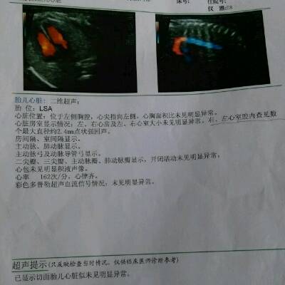 11去做了四维彩超,一切都很正常,但胎儿心脏彩超显示左右心腟内查见数