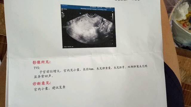 怀孕45天一点怀孕症状都没有是不是不正常_你