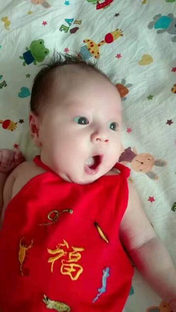 宝宝湿疹老不好