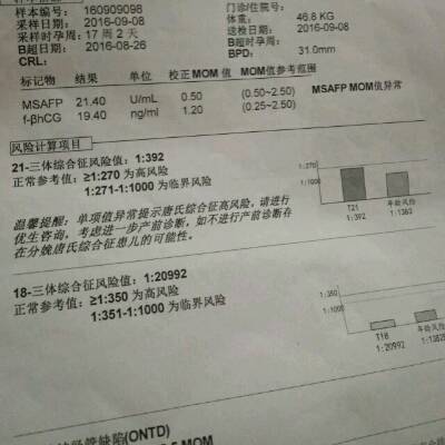 唐氏筛查21_三风险为1:392生出来的娃回事唐氏儿?现在