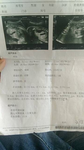 31周彩超检查胎儿左肾积水1.7右肾0.7有同样的