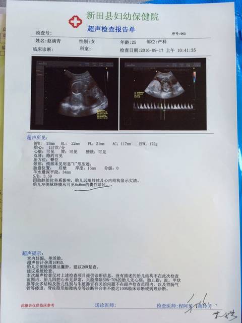 有宝妈跟我一样的情况吗?