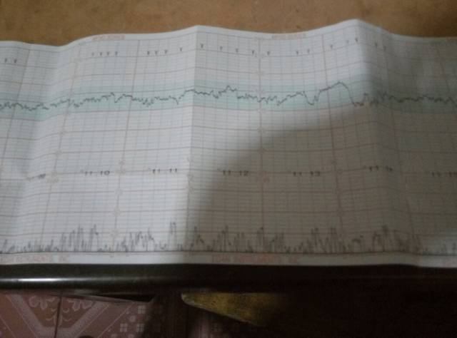 怀孕33周_谁会看胎心监护图呀,今天去医院检查