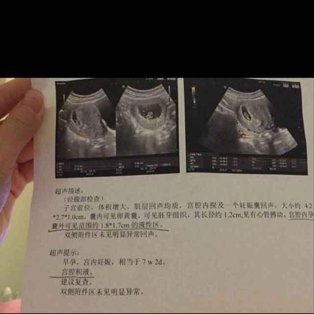已见胎心胎芽,但是还有宫腔积液,怎么办!_今天