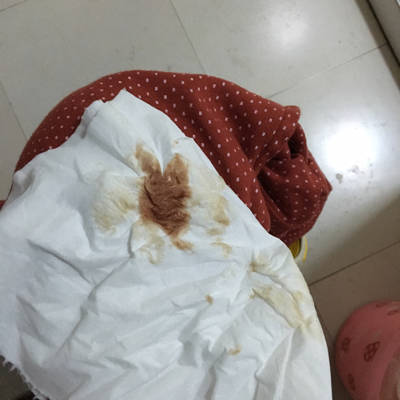 前天刚查出怀孕,有点出血,昨天医生给开了黄体