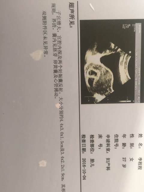 谁给算算男孩女生_怀孕46天,今天做b超,双胞女孩疤的烟有图片