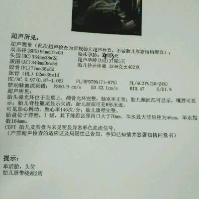 孕37周多,胎儿脐带绕颈两周怎么办,挺担心的.帮忙看一