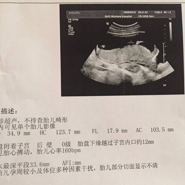 怎么看男宝女宝_孕17周!怎么看男孩女孩!