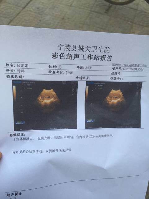 帮忙看一下是男孩还是女孩?_这是怀孕58天的