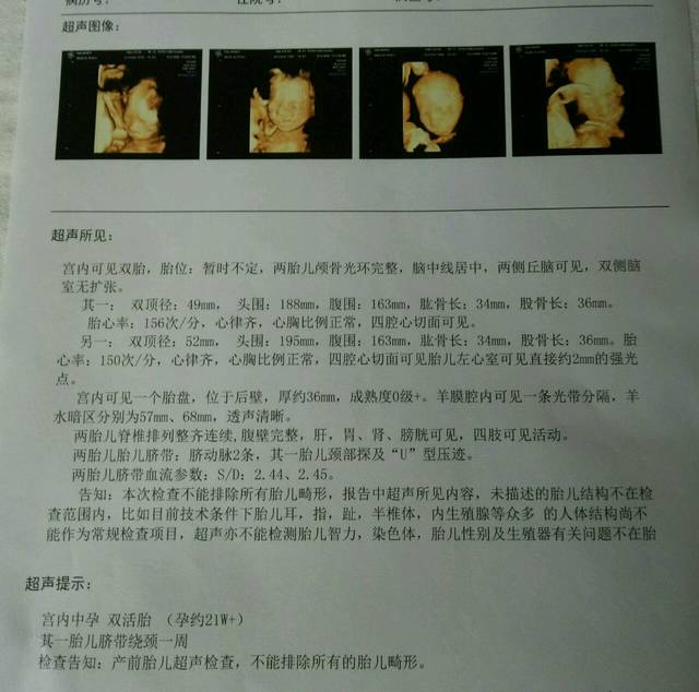 b超 看男宝女宝 四维刚做双胞胎