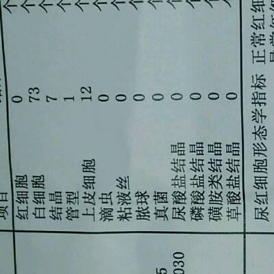 验尿结果,医生我有事吗?尿胆原3.3umo1\/1,比重