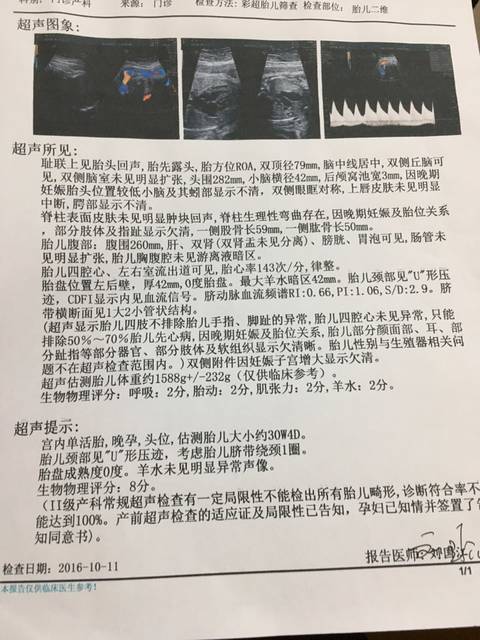 28周以上B超单数据才能。及及_可以发B超图