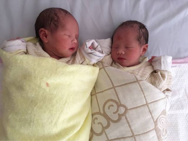 报喜了,超快顺产同卵双胞胎男宝