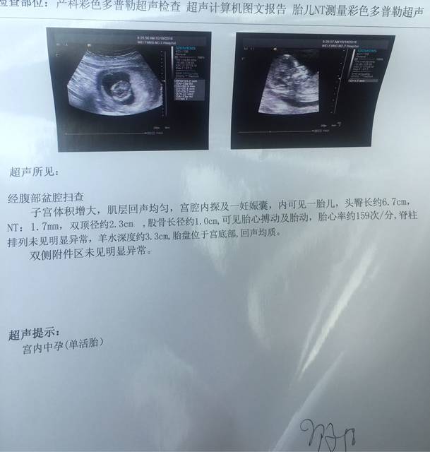 13周,nt、b超图,有会看男女的大神吗_帮我看下跪谢啦_宝宝树