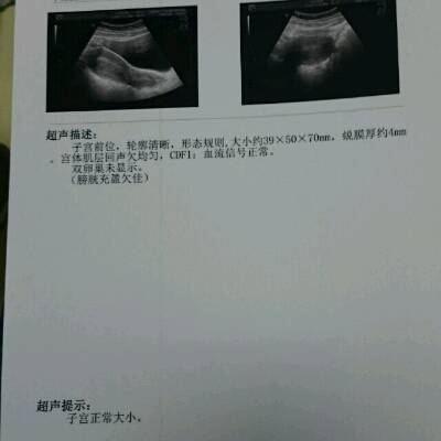 请问医生,这是今天是药流后的第六天去医院复