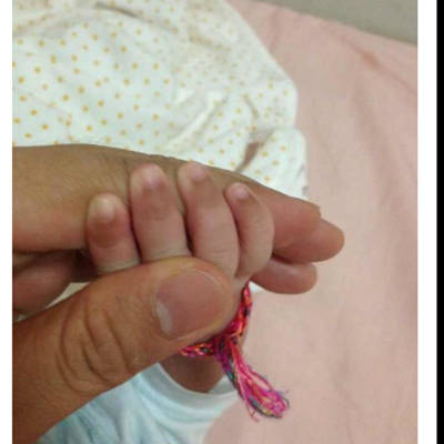 宝宝手指甲下方第一节手指发黑是怎么回事?两