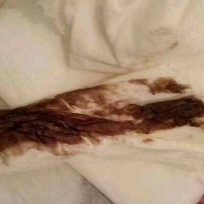 我26号刚检查出来怀孕,从医院回来的那天晚上下面就开始流黑色的,因为