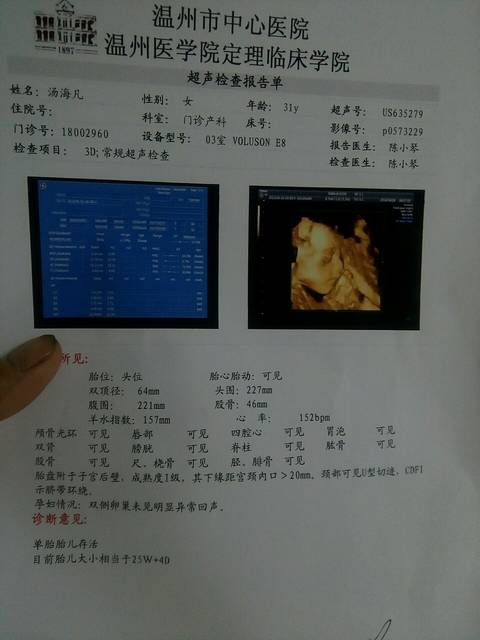 糖豆_今天刚做的三维彩超 宝宝正常_宝宝树