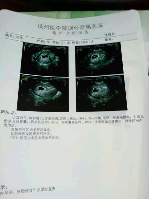 8月20末次月经,月经不规律,46天查出怀孕做了彩超有孕囊没有胎芽