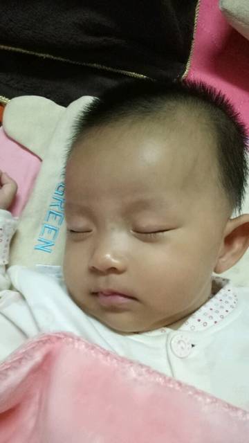 !三个多月宝宝鼻子上面那里长白斑是怎么回事