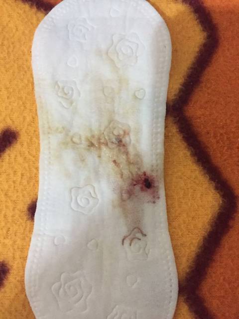 出血后褐色分泌物持续了10天左右好了(有图)_孕26周左右大_宝宝树