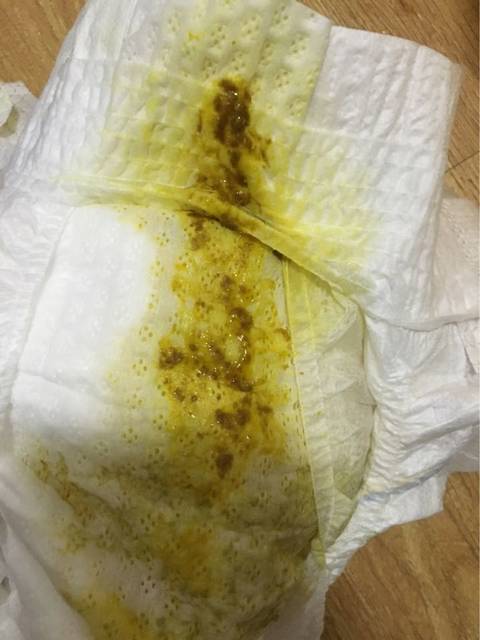 宝宝拉肚子咋办