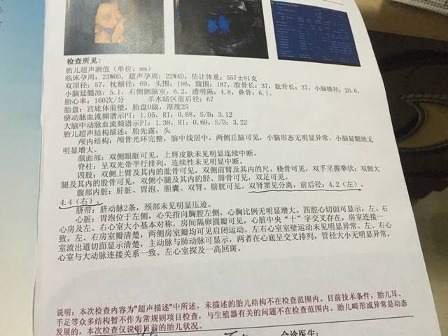 三维彩超。结果很担心~_双肾窦分离，左4.2，右4.4。要不_宝宝树
