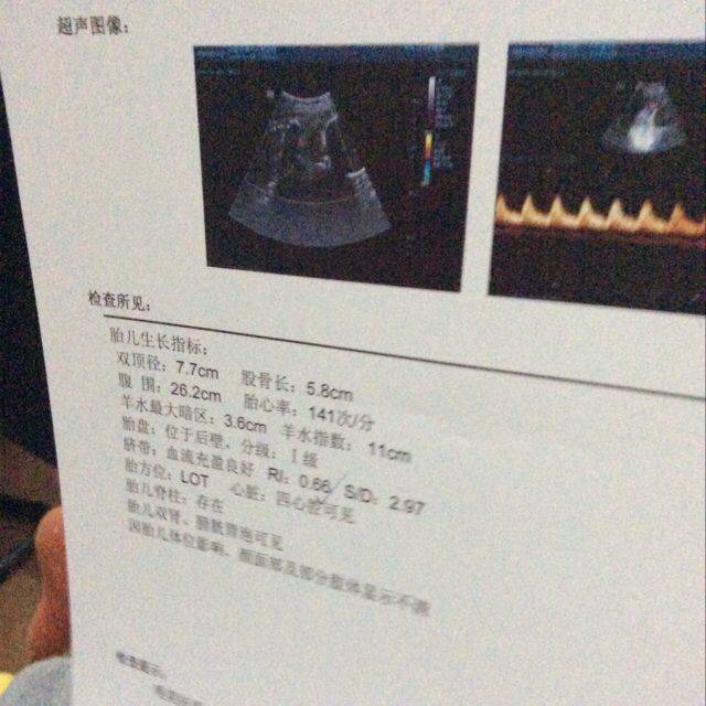 谁会算胎儿体重阿_双顶径77 股骨长58 腹围26